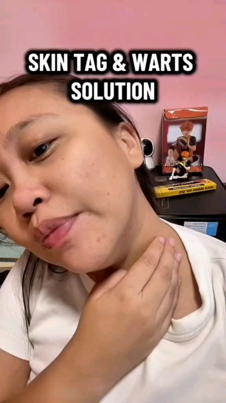 #Bioessence #Warts #ShopeeBudol #ShopeeFinds #MasMuraSaShopee #ShopeePHCommsXTRA #FreeCoinsInShopeeVideo #foryou #fyp