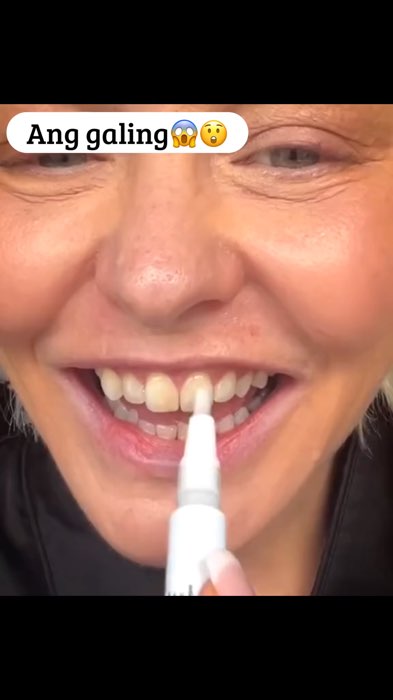 #TeethWhitening #whiteningpen #fyp