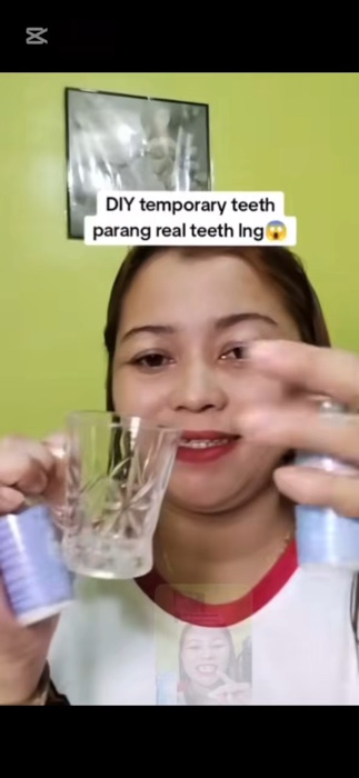 Temporary Moldable False Teeth #FreeCoinsInShopeeVideo #HugotSaShopee #MasMuraSaShopee #shopee #paydaysale #fyp #trending #trend #moldableteeth