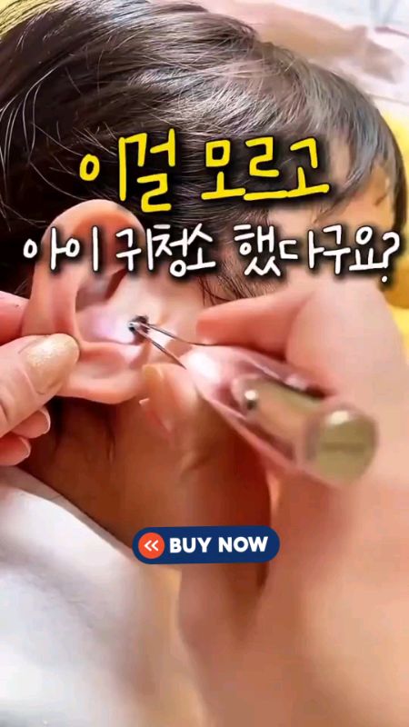 #earwaxcleaning #earpick #earwaxremoval #earpickwithlight