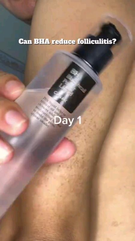 BHA 4% Blackhead Power Liquid 100ml/50ml, BHA 4%, Willow Bark Water 65%,
