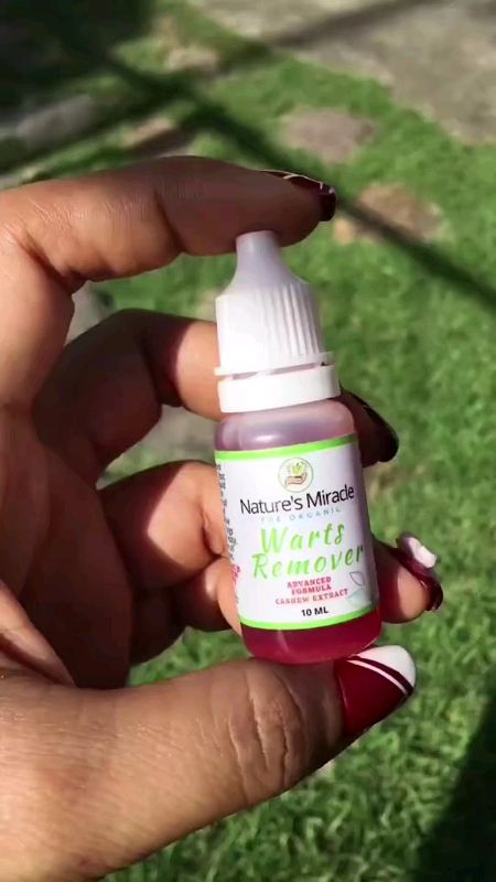 #WartsRemover #KasoyOil #warts Remover Original Mole Remover #Kulogo #BuniRemoval #trending #tool #fashion #diy