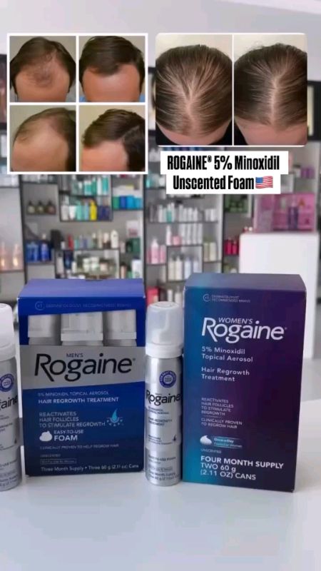 Hair thinning hair loss? use Rogaine minoxidil #haircare #hairloss #minoxidil #rogaine #shopeefinds