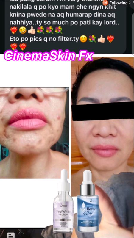 #cinemaskinfx #antiaging #agereset #whitening #antiwrinkles  #masmurasashopee #freecoinsinshopeevideo #HugotSaShopee #beauty
