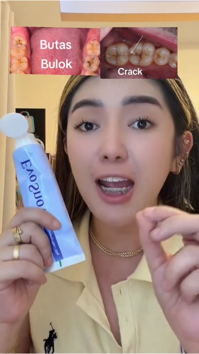 Be consistent, para makita mo resulta beh #highlyrecommended #teeth #toothpaste #evosnowtoothpaste #enamelrepair #TeethWhitening #freshbreath