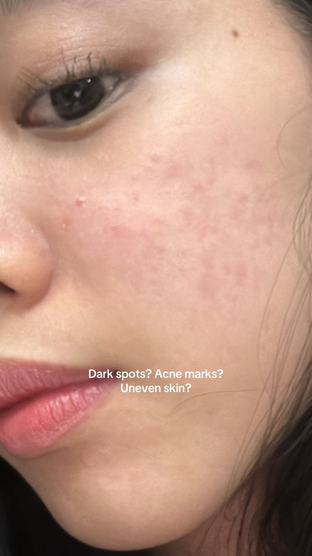 From dark spots to brighter skin One bottle for face & body lang ✨ #teashell #TeashellNiacinamide
